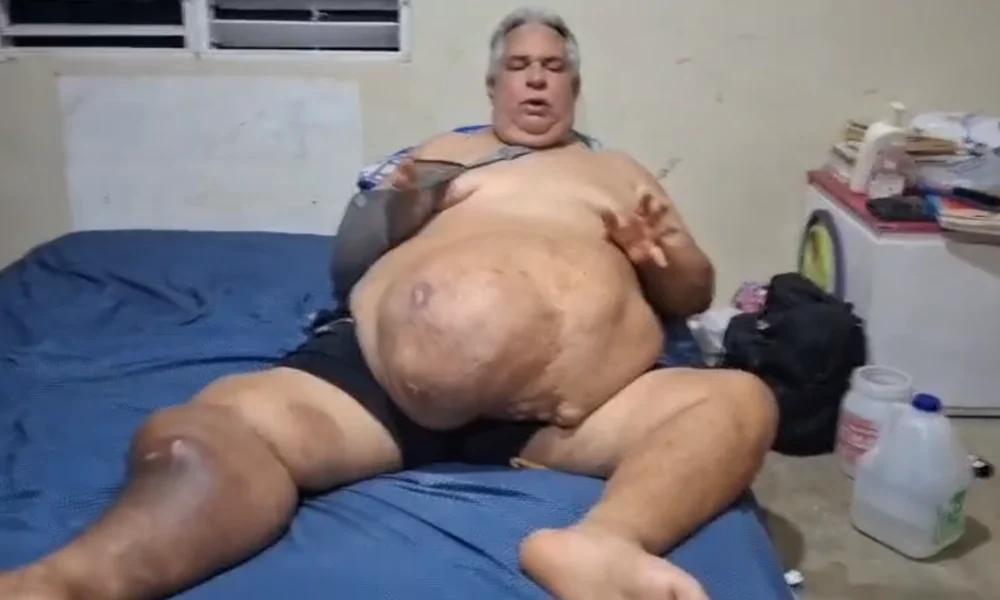 Basilio Antonio Taveras Guzmán solicita ayuda para operarse de un tumor abdominal en Moca.