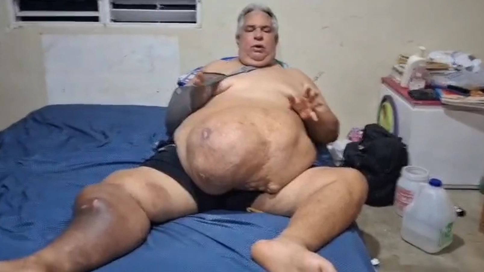 Basilio Antonio Taveras Guzmán solicita ayuda para operarse de un tumor abdominal en Moca.